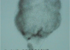 Imagerie