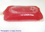 hemoperitoine