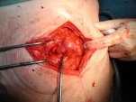 encapsulante2