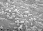 recolonisationmesothelium
